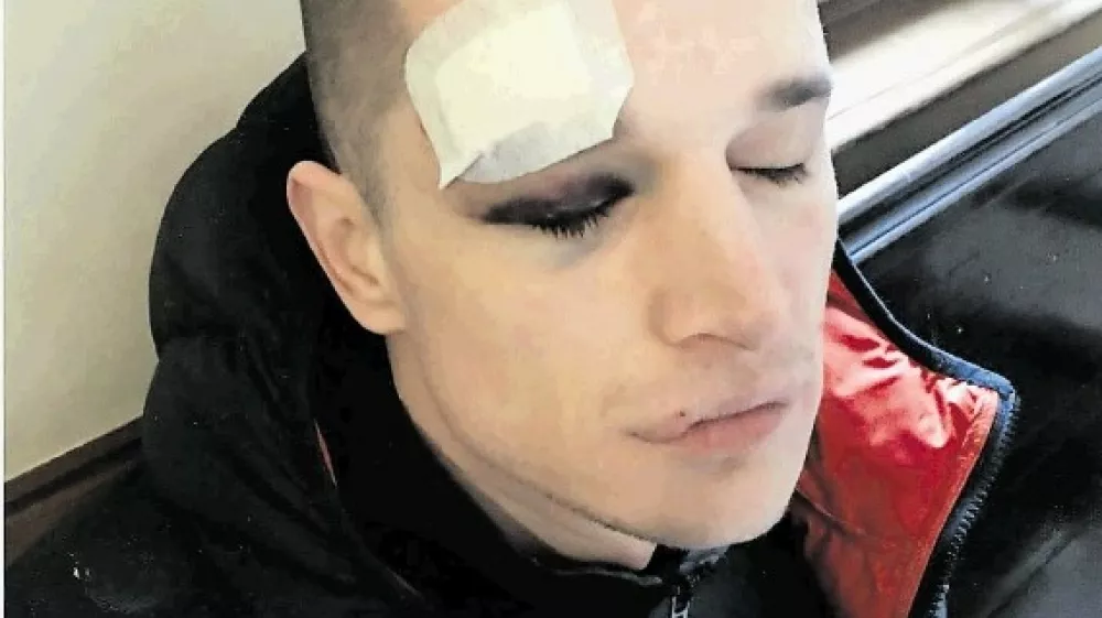 Klemen Rajnar trdi, da so ga policisti ob aretaciji po&scaron;kodovali in nato zasli&scaron;ali, ne da bi prej poklicali zdravnika in odvetnika.