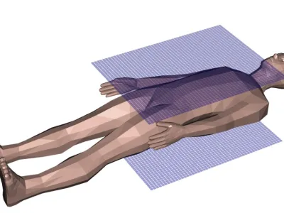 Z novimi napravami bo pozitronska tomografija (CET) lahko ceneje in bolj učinkovito zajela člove&scaron;ko telo v celoti.