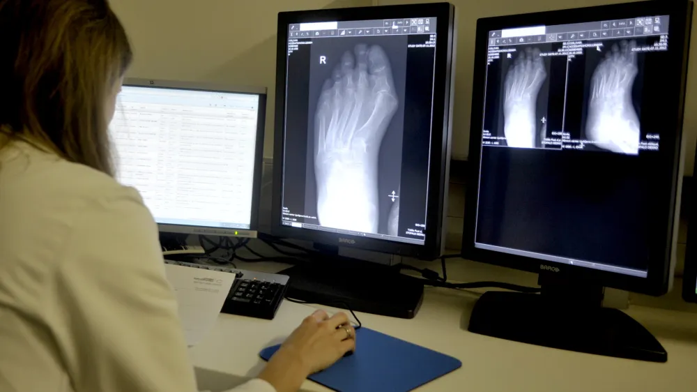 - ilustrativna fotografijarentgen, rentgenska slika, digitalni rentgen, radiologija, radiologinja, radiologi- Klinični in&scaron;titut za radiologijo UKC v Ljubljani ob mednarodnem dnevu radiologije predstavili nove metode zdravljenja;//FOTO: Tomaž Zajel&scaron;nik