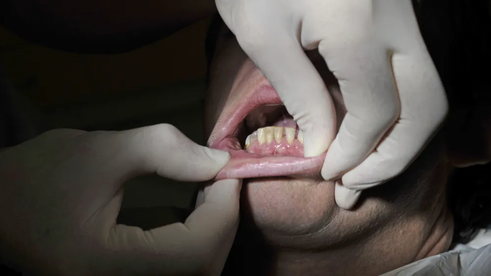 - ilustrativna fotografija- zobozdravnik, zobozdravstvo, bolezni zob in dlesni    //FOTO: Tomaž Zajel&scaron;nik