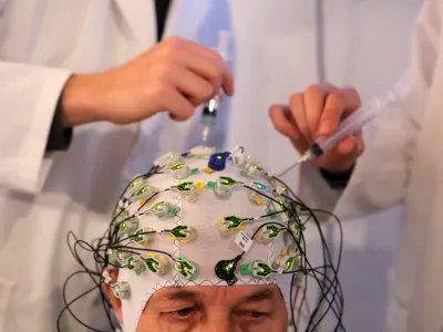 - simbolična fotografija - demenca - Alzheimerjeva bolezen - možganska bolezen - zdravstvo - - 09.05.2017 - predstavitev vseslovenskega projekta zgodnjega odkrivanja demence Adam, ki bo potekal pod vodstvom kliničnega oddelka za bolezni živčevja Nevrolo&scaron;ke klinike UKC Ljubljana, //FOTO: Luka Cjuha