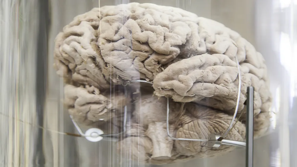Human brain, detail of a human organ, intelligence and thought