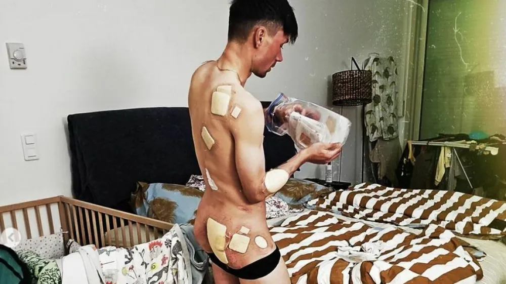 Primož Roglič je na 3. in 4. etapi Dirke po Baskiji utrpel hude odrgnine.