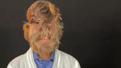 Ferrari Press Agency Hairy 1Ref 1660506/03/2025See Ferrari textPictures must credit: Guinness World RecordsA teenager with a condition that causes abnormal hair growth all over his body has gained a record &mdash; for having the hairiest male face in the world.Lalit Patidar, 19, from India, has hypertrichosis which causes excessive hair growth. The title was confirmed by the Guinness World Records.In order to assess him he visited Italy to take part in a television show andwhilst in the country he visited a local trichologist who assessed him.To take accurate measurements, tiny portions of Lalit's face were shaved to assess how many hairs per square cm he has.They discovered he has 201.72 hairs per square cm.A spokesperson said: "The results confirmed that Lalit indeed does have the hairiest face in the world."OPS: Lalit Patidar Picture supplied by Ferrari,Image: 972774911, License: Rights-managed, Restrictions:, Model Release: no