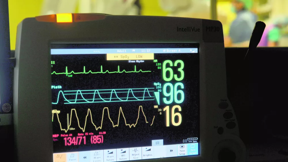 - ilustrativna fotografijazdravstvene preiskave, zdravstveni pregled, radiologija, bolni&scaron;nica, zdravje, merjenje vitalnih znakov, monitor, medicina- Klinični in&scaron;titut za radiologijo UKC v Ljubljani ob mednarodnem dnevu radiologije predstavili nove metode zdravljenja;//FOTO: Tomaž Zajel&scaron;nik