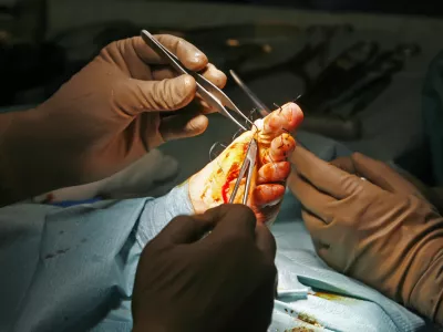 - 23.03.2015 - Ortopedska klinika UKC v Ljubljani - Oddelek za artroskopijo in po&scaron;kodbe pri &scaron;portu - operacija nožnega palca (haluks valgus), - operacijska dvorana - - kirur&scaron;ki operativni poseg - zdravstvo //FOTO: Tomaž Skale