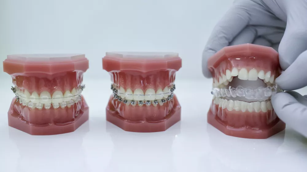 Pri načrtovanih zdravljenjih v tujini je posebej veliko storitev s področja zobozdravstva: ortodontskih, kjer gre za zdravljenje zobnih in čeljustnih nepravilnosti, in endodontskih, kjer bolniki med drugim potrebujejo zdravljenje zobnih korenin. Foto: Jaka Gasar