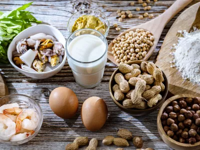 Na krožniku se lahko pri nas ali drugod po svetu najde marsikaj zanimivega. / Foto: Istock