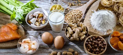 Na krožniku se lahko pri nas ali drugod po svetu najde marsikaj zanimivega. / Foto: Istock