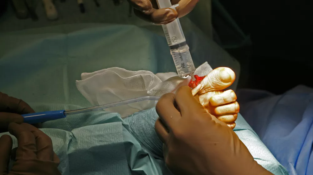 Prebivalci ob zadržanih pravicah ostanejo brez dostopa do &scaron;tevilnih zdravljenj. Fotografija je simbolična. Foto: Tomaž Skale