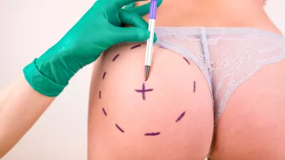 Surgeon drawing marks on female body before plastic operation, white background. Liposuction concept / Foto: Georgiy Datsenko