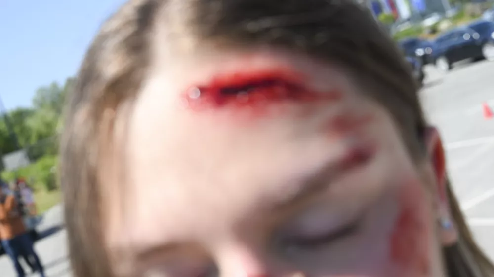 E - SKIROSKIRO SIMBOLIČNA FOTOGRAFIJAvarnost v prometu električni skiroprometna nesrečasmrt v prometupromettrčenjetrknasiljepo&scaron;kodbe glavepo&scaron;kodbaranakrinasilje nad ženskami14.05.2025 Novinarska konferenca: " Varno z e-skirojem "FOTO: Nik Erik Neubauer