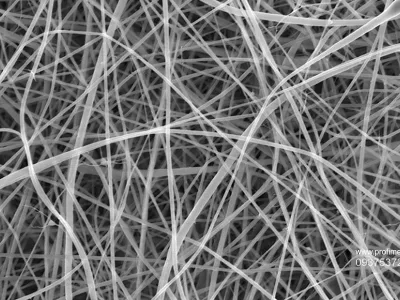 Ferrari Press Agency Thinnest pasta 1 Ref 1633922/11/2024See Ferrari textPicture MUST credit: Beatrice Britton / Adam Clancy / UCLThe world's thinnest spaghetti, 200 times less thick than a human hair, has been created by researchers.The stringy pasta favourite is not intended to be a new food but was created because of the wide-ranging uses that extremely thin strands of material, called nanofibers, have in medicine and industry.Nanofibers made of starch &ndash; produced by most green plants to store excess glucose &ndash; are especially promising and could be used in bandages to aid wound healing, as scaffolding for bone regeneration and for drug delivery. However, they rely on starch being extracted from plant cells and purified, a process requiring much energy and water.A more environmentally friendly method, the researchers say, is to create nanofibers directly from a starch-rich ingredient like flour, which is the basis for pasta.The team from the UK's University College London (UCL) made spaghetti just 372 nanometres, billionths of a metre, across using a technique called electrospinning.Threads of flour and liquid are pulled through the tip of a needle by an electric charge. The work was performed by chemistry master degree student Beatrice Britton.OPS: The world's thinnest spaghetti. Each individual strand is too narrow to be clearly captured by any form of visible light camera or microscope, so the team used a scanning electron microscope.Picture supplied by Ferrari,Fotografija:937537261, Licenca:Rights-managed, Omejitve:, Model izdaje:no