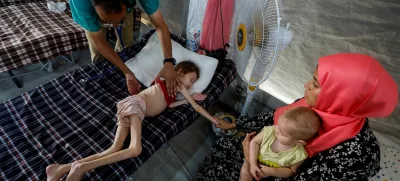 FILE PHOTO: A doctor checks Jana Ayad, a malnourished Palestinian girl, as she receives treatment at the International Medical Corps field hospital, amid the Israel-Hamas conflict, in Deir Al-Balah in the southern Gaza Strip, June 22, 2024. REUTERS/Mohammed Salem /File Photo