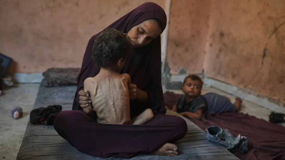 Naima Abu Ful poses for a photo with her 2-year-old malnourished child, Yazan, at their home in the Shati refugee camp in Gaza City, Wednesday, July 23, 2025. (AP Photo/Jehad Alshrafi)