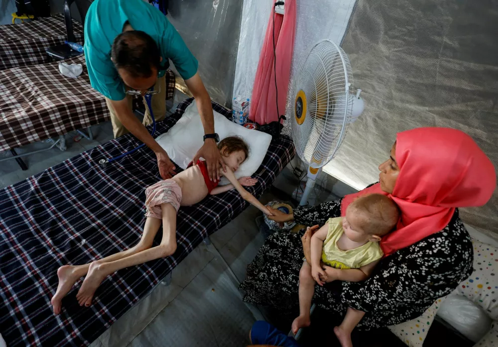 FILE PHOTO: A doctor checks Jana Ayad, a malnourished Palestinian girl, as she receives treatment at the International Medical Corps field hospital, amid the Israel-Hamas conflict, in Deir Al-Balah in the southern Gaza Strip, June 22, 2024. REUTERS/Mohammed Salem /File Photo