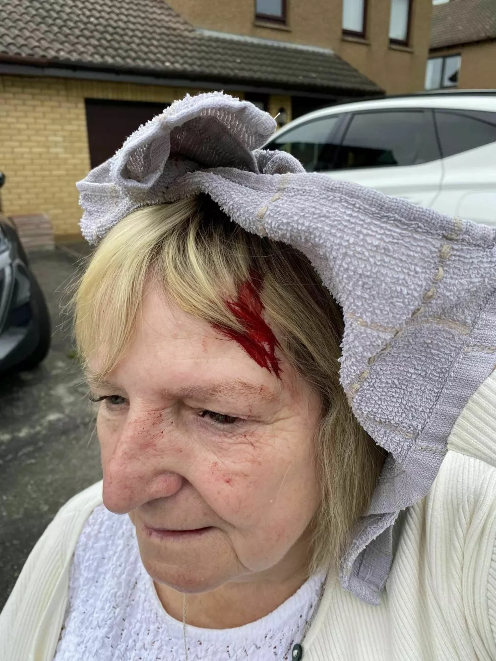 Lesley Wright, after she was attacked by a seagull. A woman was rushed to hospital with a head wound after she was attacked - by a seagull. Lesley Wright, 70, was left with a bleeding scalp that required medical attention after the unprovoked attack by the bird. She was walking to a neighbour's house in Moray in Scotland when the gull swooped in from behind and hit her in the back of the head, leaving her dazed and in pain. Lesley was left with a scar and a bald patch - and is questioning why seagulls are a protected species. Photo released 17/08/2025,Image: 1030041610, License: Rights-managed, Restrictions: Editorial use, commercial use may require additional licenses. We don't use AI to make images which could be mistaken for news photos. AI use will be clearly indicated. Supplied on condition you ensure personal data is processed in compliance with UK GDPR, Model Release: no