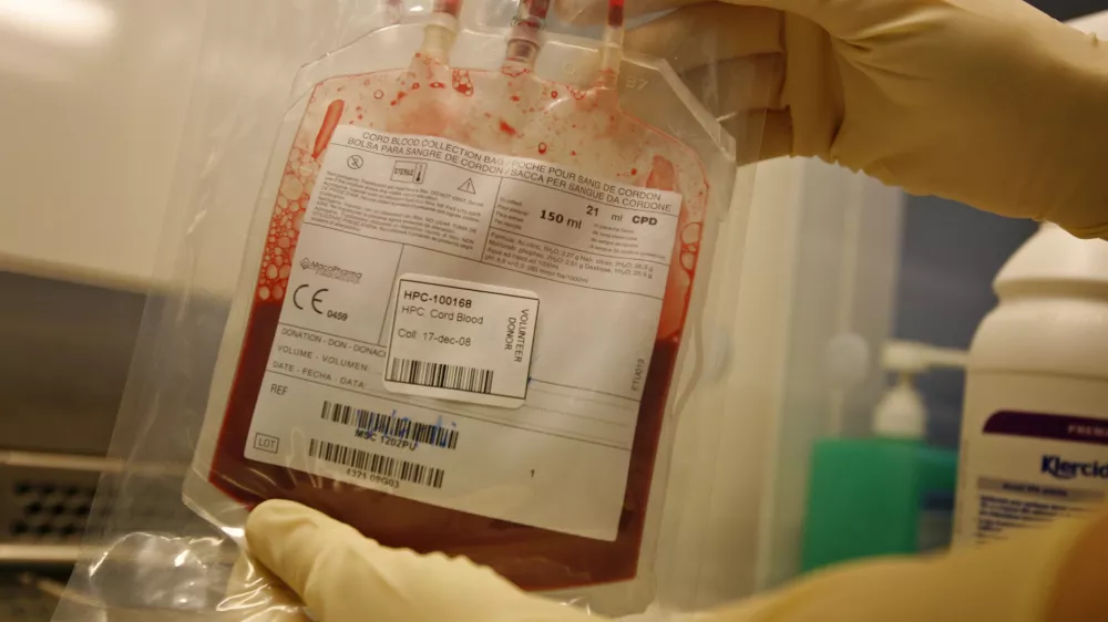 Matične celice iz popkovnice - matične celice iz popkovnične krvi imajo velik potencial za zdravljenje bolezni v prihodnosti - nastanejo ob spočetju in so temelj življenja - to so nerazvite osnovne celice, ki se lahko pod določenimi pogoji razvijejo v katerokoli celico, npr. v mi&scaron;ice, živčevje ali drugo tkivo v telesu. Nekatere pa se ne specializirajo, temveč opravljajo nalogo regeneracije tkiva.- Zavod RS za transfuzijsko medicino - //FOTO: Matej Pov&scaron;eOPOMBA: ZA OBJAVO V ČASOPISU DNEVNIK