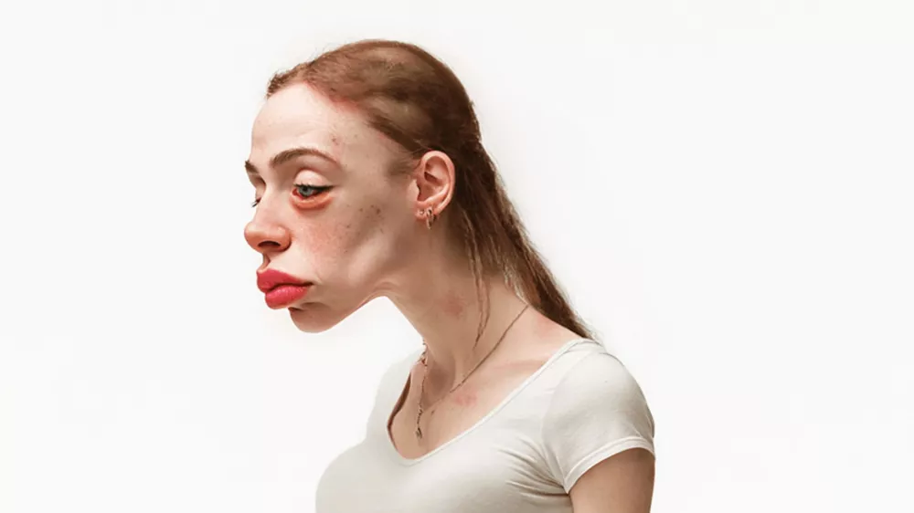 Posledice bodo menda vidne tudi na obrazu. / Foto: Profimedia