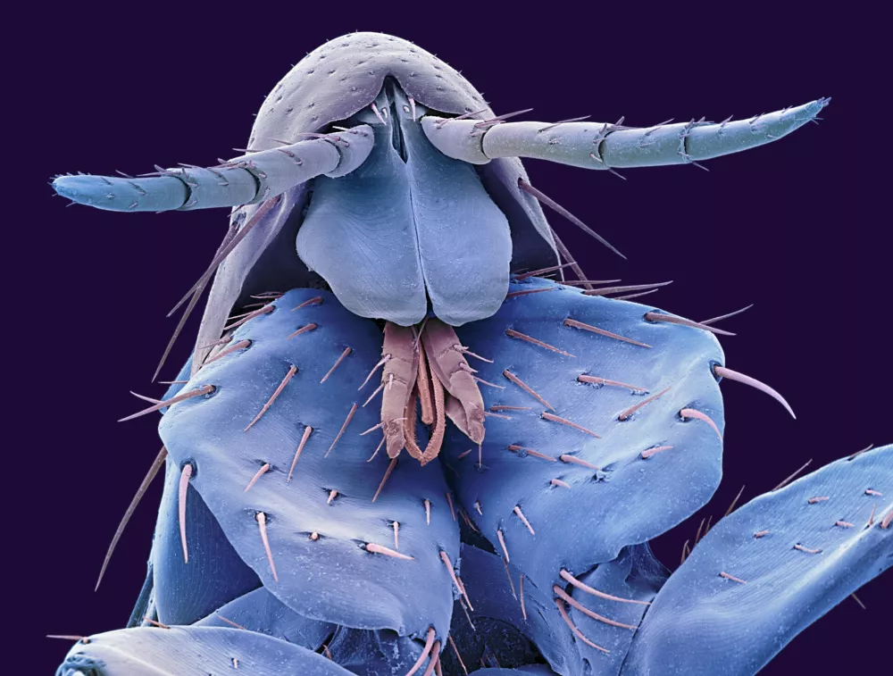 Human flea. Coloured scanning electron micrograph (SEM) of the head of a human flea (Pulex irritans). At upper centre are two sensory palps. At centre are the mouthparts, which pierce the skin to enable the flea to suck the blood of its host. Fleas are external parasites that may carry and transmit diseases, including the plague. The itchiness associated with a flea bite is mainly due to an allergic reaction to the flea's saliva or faeces that have been deposited near the bite and rubbed into it by scratching. Magnification: x33 at 10 centimetres wide.,Image: 103065114, License: Rights-managed, Restrictions:, Model Release: no / Foto: Profimedia