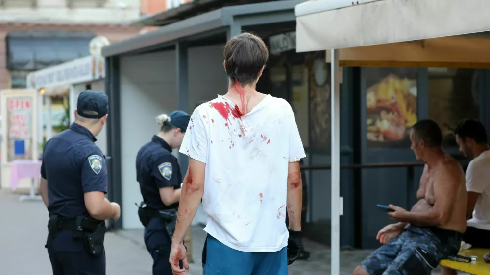 Priče so poročale o udarcih v glavo, glasnik krikih in prelivanju krvi, po pisanju hrva&scaron;kih medijev pa naj bi eden od pretepačev segel celo po pi&scaron;toli za žeblje. 