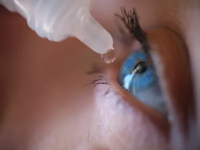 Woman applying eye drops to eye. Eye care and beauty concept.