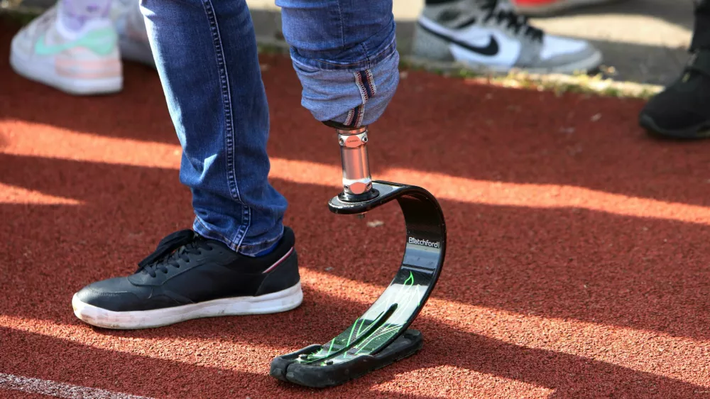 simbolična fotografija- nožna proteza, invalidnost- 19.04.2023 - dogodek 100 slovenskih &scaron;portnikov in para&scaron;portnikov za en namen - V &scaron;portu smo vsi enaki, na katerem je 85 &scaron;portnikov in 15 para&scaron;portnikov s simbolno gesto pokazalo, da so invalidi kljub različnosti v življenju vsi enaki in da si vsi zaslužijo enake možnosti, hkrati pa obeležili 500 dni do paraolimpijskih iger v Parizu //FOTO: Tomaž Skale