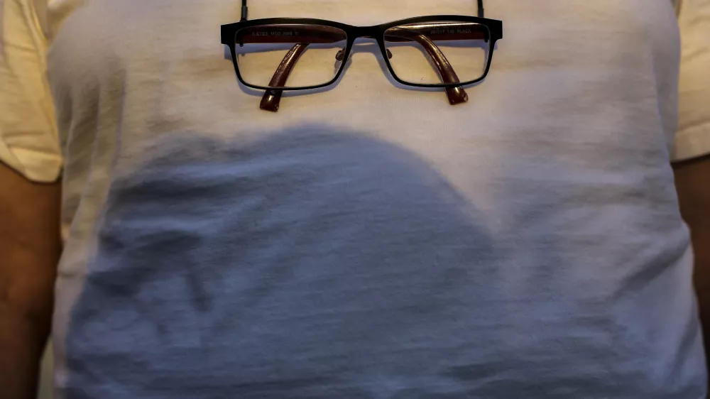 Pravice zavarovancev: Kdaj so brezplačni pregledi, kdaj očala?