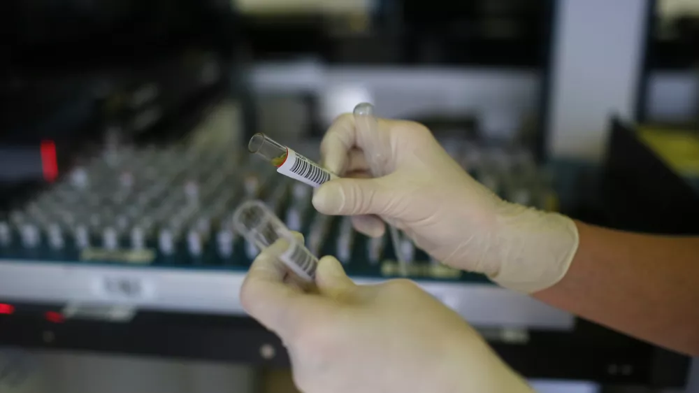 - simbolična fotografija - zdravstvo ﻿- sprejem biolo&scaron;kega materiala - epruvete - 24-urni laboratorij KIKKB - In&scaron;titut za klinično kemijo in biokemijo- 02.10.2014 - UKC - Univerzitetni klinični center v Ljubljani - dan odprtih vrat laboratorijev klinične kemije in laboratorijske medicine, laboratorij //FOTO: Jaka Gasar