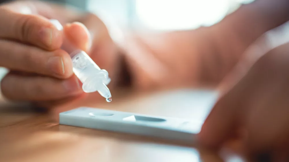 test je &scaron;e vedno edini zanesljivi pokazatelj tega, za čem smo zboleli. / Foto: Istock