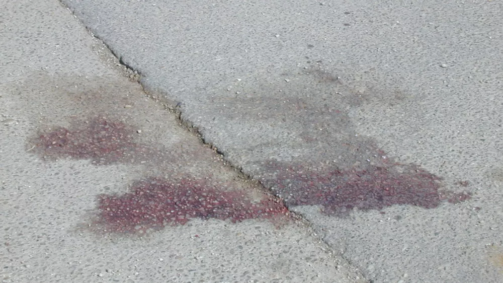 Pretepeni Jože Činč