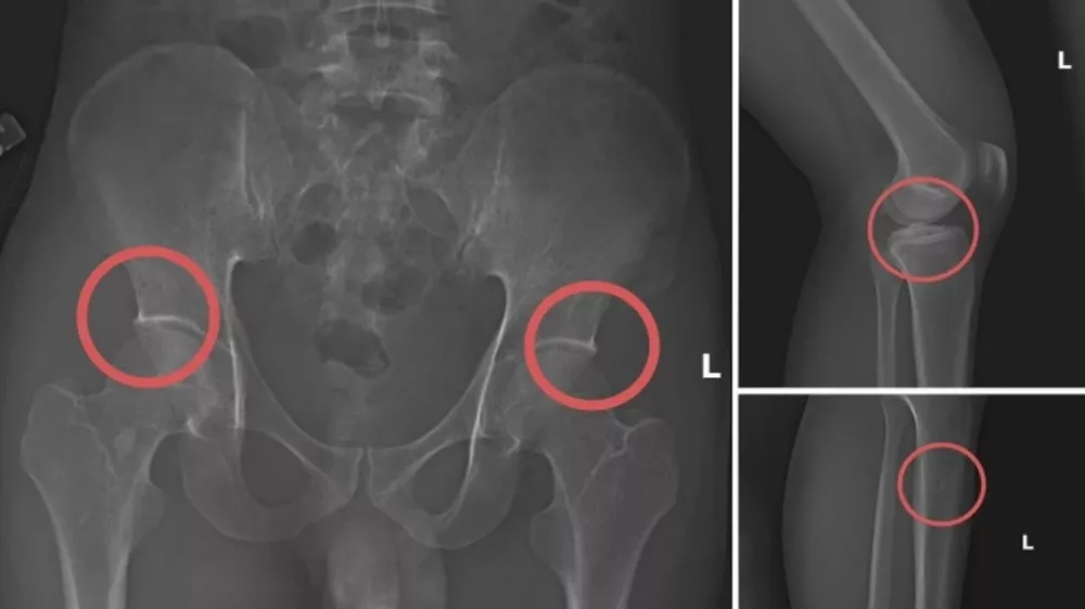 Posnetki, ki jih je medijem razdelila tamkaj&scaron;nja policija.