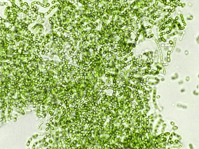 Probiotične bakterije pod mikroskopom / Foto: Istock