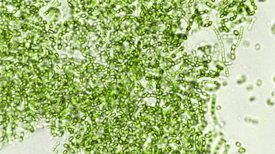 Probiotične bakterije pod mikroskopom / Foto: Istock