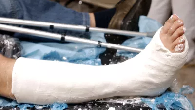 Urgenca - mavčarna, Klinični center gips noga mavec