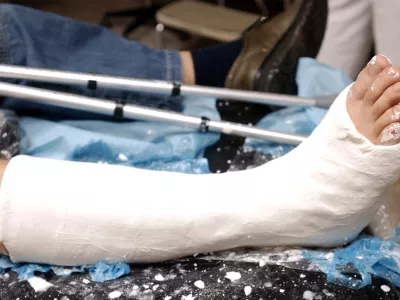 Bolni&scaron;ka odsotnost: Kako bo videti laični nadzor in kaj skrbi detektive?