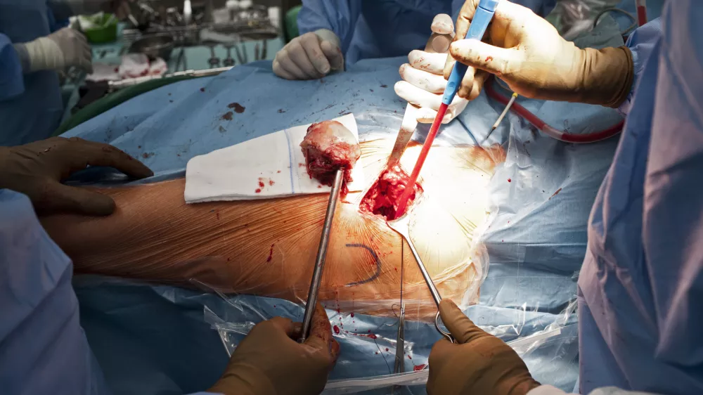 Koliko delajo zdravniki? Že zdaj bi morali spremljati obremenitve zaposlenih