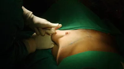 lepotna kirurgija, Glumičič Medical Group - lepotna kirurgija, Sini&scaron;a Glumičič