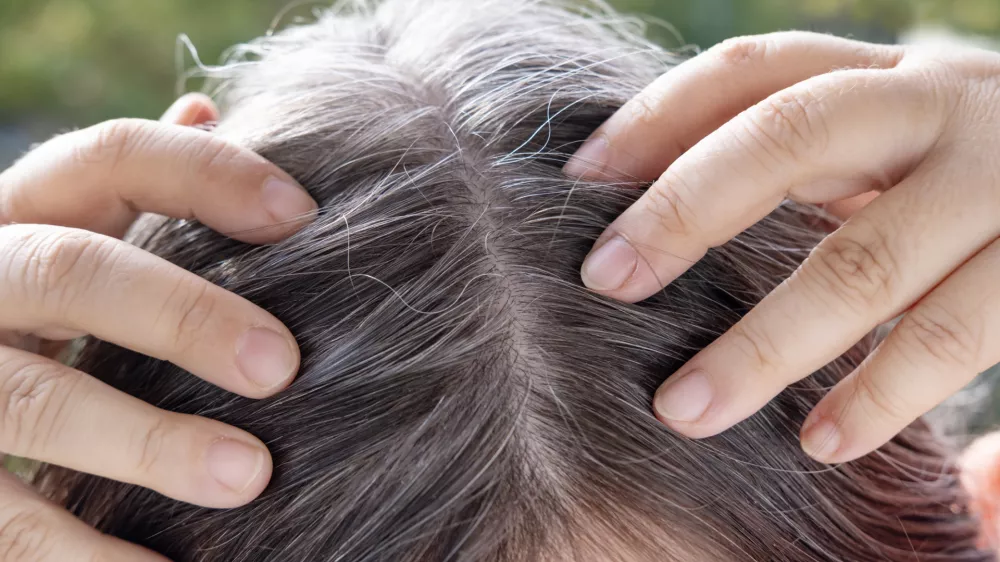 Aging with grace and confidence, brown-haired woman with long brown hair with gray hair, female forehead close-up, hands hold strands of hair, Hair care and grooming for mature women / Foto: Victor Golmer
