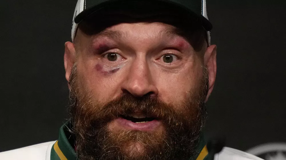 FILE - Britain's boxer Tyson Fury speaks at a press conference after loosing his fight against Ukraine's boxer Oleksandr Usyk for the WBA, WBO, and WBC heavyweight title in Riyadh, Saudi Arabia, Sunday, Dec. 22, 2024.(AP Photo/Frank Augstein, File)