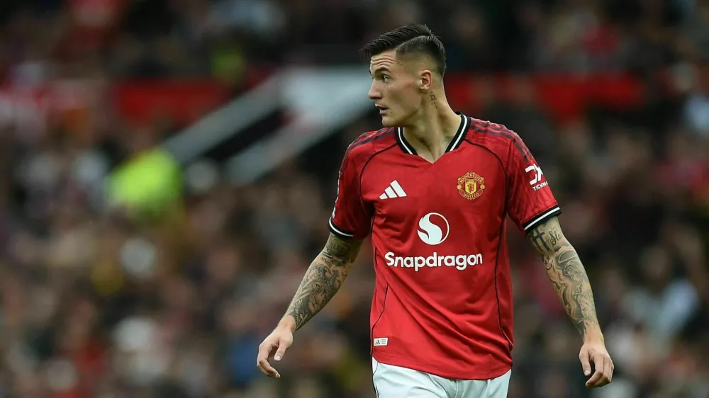 Soccer Football - Premier League - Manchester United v Burnley - Old Trafford, Manchester, Britain - August 30, 2025 Manchester United's Benjamin Sesko REUTERS/Peter Powell EDITORIAL USE ONLY. NO USE WITH UNAUTHORIZED AUDIO, VIDEO, DATA, FIXTURE LISTS, CLUB/LEAGUE LOGOS OR 'LIVE' SERVICES. ONLINE IN-MATCH USE LIMITED TO 120 IMAGES, NO VIDEO EMULATION. NO USE IN BETTING, GAMES OR SINGLE CLUB/LEAGUE/PLAYER PUBLICATIONS. PLEASE CONTACT YOUR ACCOUNT REPRESENTATIVE FOR FURTHER DETAILS..