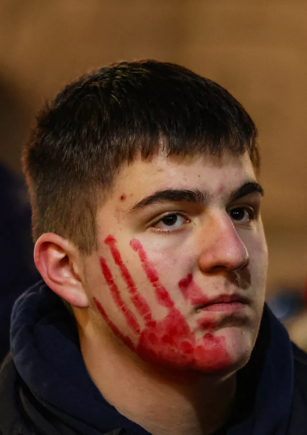 A young man has the shape of a hand painted in red over his face as he takes part in the first protest of the year, after months of rallies demanding political accountability and elections, following the deadly collapse at the city's railway station, in Novi Sad, Serbia, January 17, 2026. REUTERS/Zorana Jevtic