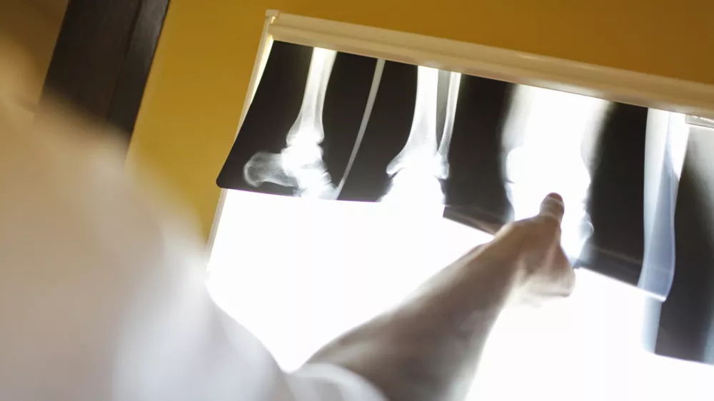 Urgenca UKC - Urgentni kirur&scaron;ki blok  - simbolična fotografija - zdravstvo - zdravniki -  ///FOTO: Luka Cjuha///FOTO: Luka Cjuha