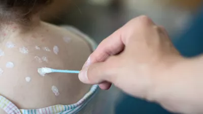 / Foto: Getty Images