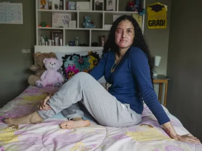 FILE -- Nafiah Ikram, at home in Elmont, N.Y., on April 22, 2021, was severely burned after someone threw acid in her face outside her home. A man was charged with assault on Feb. 10, 2026, five years after the attack.,Image: 1073885068, License: Rights-managed, Restrictions: A MARCH 17, 2021 FILE PHOTO., Model Release: no