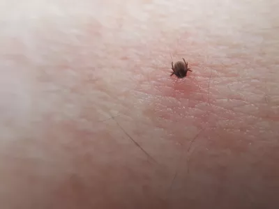 Tick Ixodes ricinus on human skin. tick wandering over human hand. Encephalitis tick