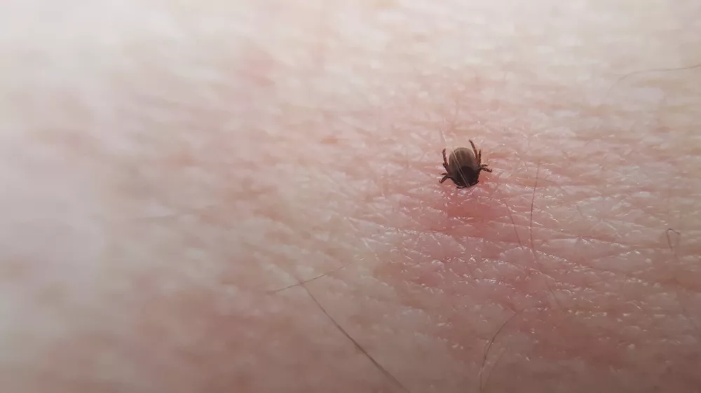 Tick Ixodes ricinus on human skin. tick wandering over human hand. Encephalitis tick
