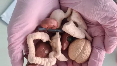 Gastroenterologist holds in hands models of organs for examination. Medical insurance, healthcare and internal organs / Foto: Nadzeya Haroshka Getty Images