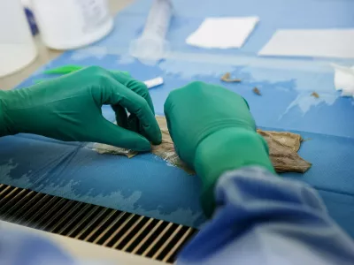 Člove&scaron;ko tkivo, Biobanka. Foto: Profimedia