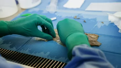 Človeško tkivo, Biobanka. Foto: Profimedia